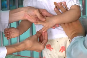 Tay chân miệng đang có xu hướng gia tăng nhanh và lan rộng, đặc biệt ở nhóm trẻ nhỏ.