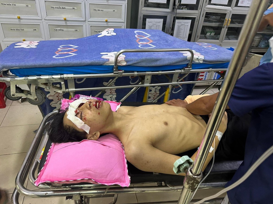 Tú được nhập viện trong tình trạng hết sức nguy kịch. Tú được nhập viện trong tình trạng hết sức nguy kịch.