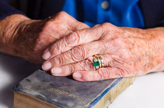 Làm tốt 4 điều này, bạn sẽ không phải lo về đốm đồi mồi xuất hiện ảnh 4