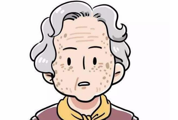 Làm tốt 4 điều này, bạn sẽ không phải lo về đốm đồi mồi xuất hiện ảnh 1