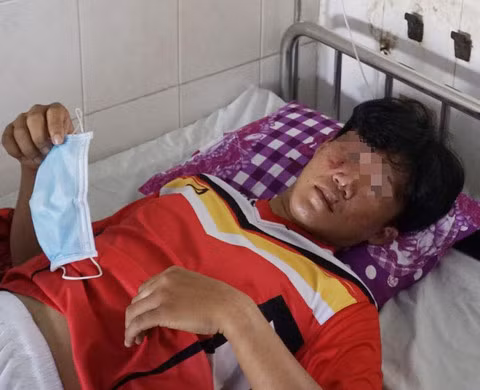 Một học sinh phải nhập viện sau khi bị hành hung. Ảnh: Baocongan
