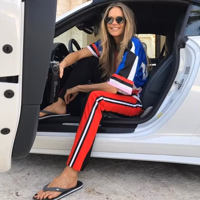 10 người mẫu "xấu xí" nhưng kiếm tiền như nước ảnh 3