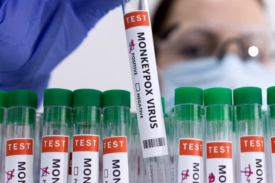 Vắc xin phòng bệnh đầu mùa trước đây vẫn có tác dụng phòng ngừa bệnh đậu mùa khỉ. Ảnh minh họa: Reuters.
