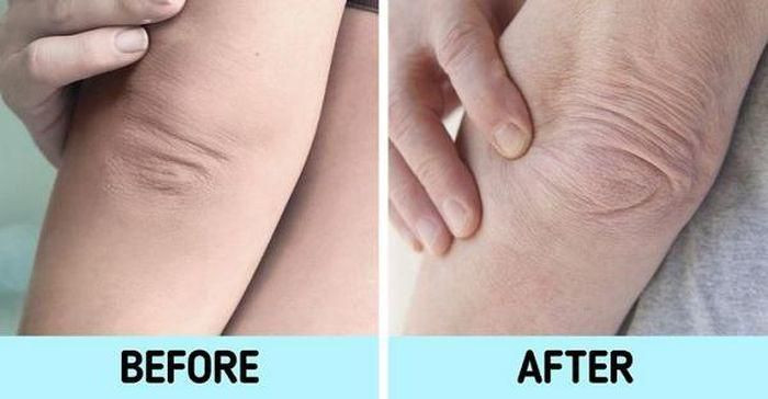 7 bộ phận cơ thể "tố cáo" tuổi thật bạn không thể giấu ảnh 1