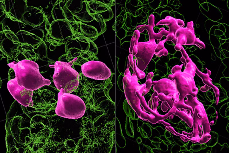 Triển vọng chữa ung thư bằng... vi khuẩn