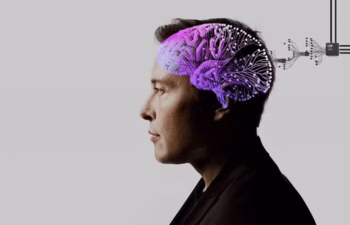 Tỷ phú Elon Musk công bố sắp cấy chip vào não người
