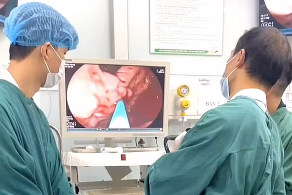 Bệnh nhân được chỉ định nội soi tiêu hóa thăm dò chức năng để tìm điểm xuất huyết. Ảnh: BVCC