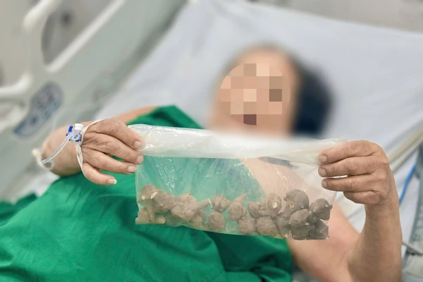 Củ ấu tầu được bệnh nhân mua qua mạng. Ảnh: BVCC