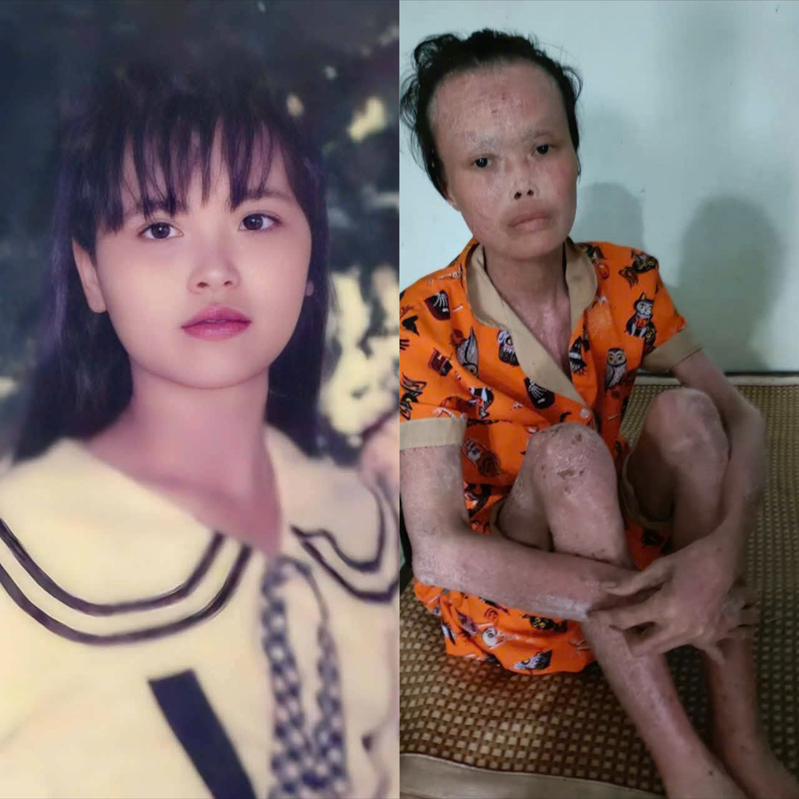 Đẫm nước mắt trước tình cảnh của cô giáo bạc mệnh 