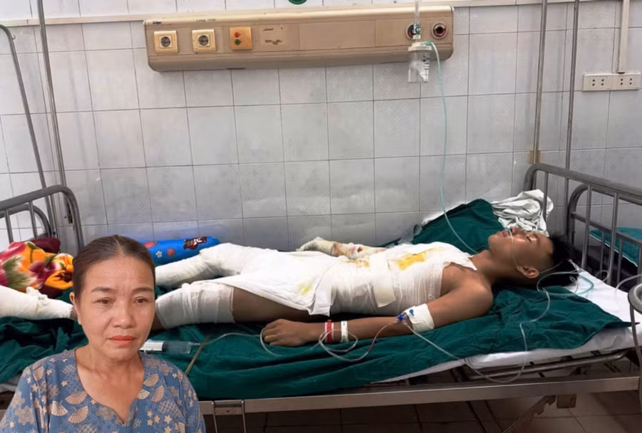 Nam sinh Hồ Sỹ Vinh bị điện cao thế phóng vào khiến toàn thân bị bỏng nặng. (Ảnh: GĐCC)