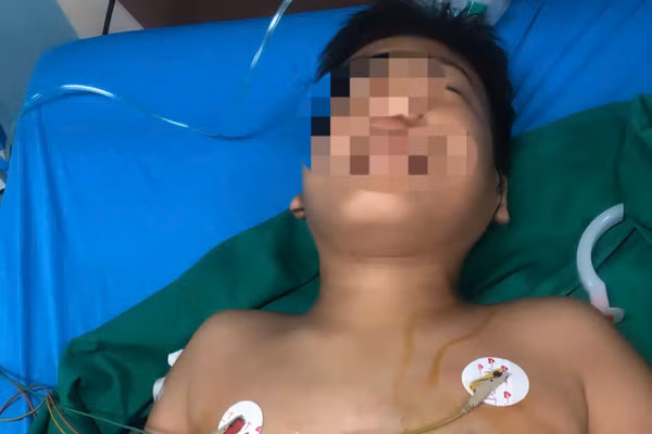 Em Trần Tấn P. (13 tuổi) trú hẻm 20 Nguyễn Khoa Đăng, phường Thành Nhất, Đắk Lắk được cấp cứu tại bệnh viện.