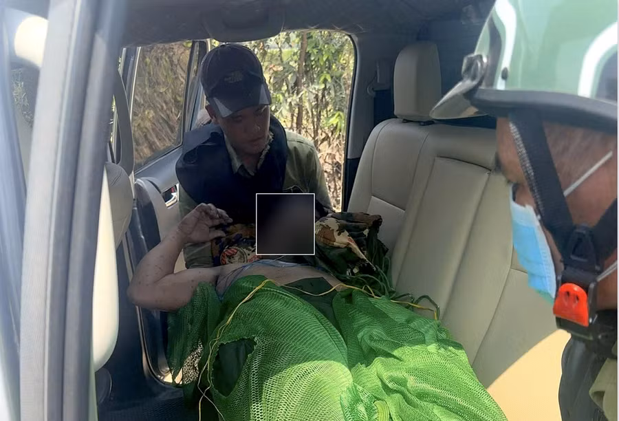 Nhân viên bảo vệ rừng của Công ty TNHH Lâm nghiệp Quy Nhơn bị ong đốt trong lúc tuần tra.