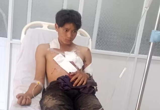 Thuât được các y bác sĩ theo dõi, điều trị sau vụ nổ mìn.