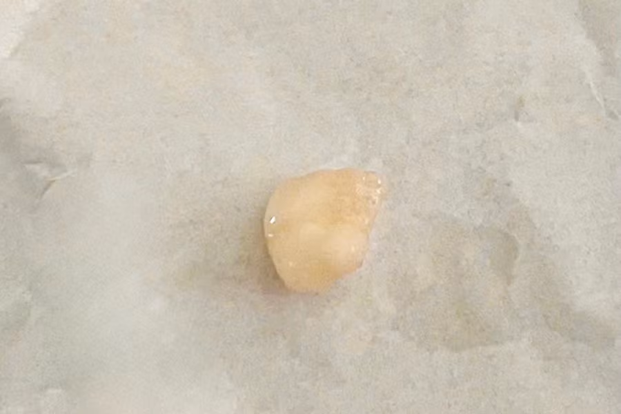0-di-vat-khoai-mi-0.jpg