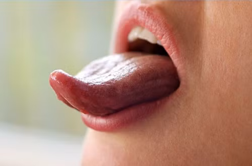Lưỡi có thể báo hiệu các vấn đề sức khỏe như ho, sốt, vàng da, đau đầu, rối loạn tiêu hóa. Ảnh: ehowcdn
