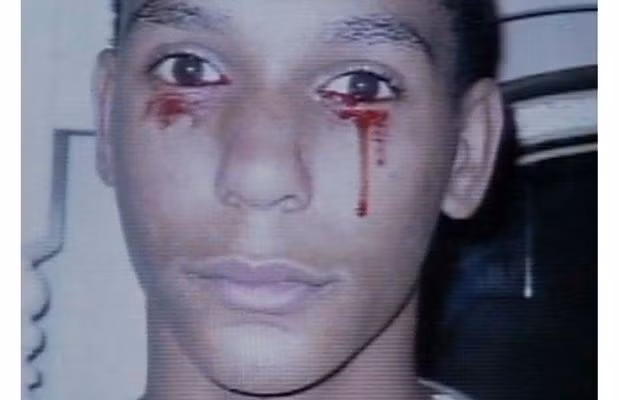 Những hiện tượng kỳ lạ trong năm 2009 ảnh 15 Meet the teenager who cries blood. Doctors are baffled by the medical condition of Calvino Inman, 15, from Tennessee. He cries uncontrollably up to three times a day. But instead of tears, blood comes streaming out of his eyes
