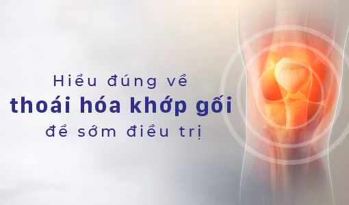 Hiểu đúng về thoái hóa khớp gối để có phương pháp điều trị thích hợp