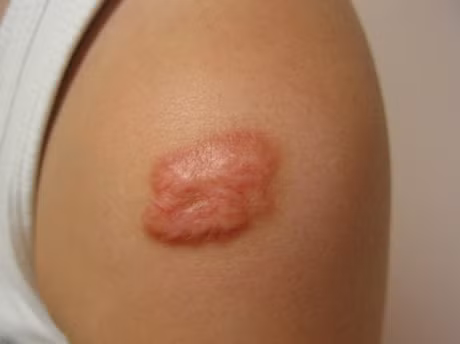Phat hien 9 dau hieu nho nay tren co the, hay canh giac voi nhung can benh nguy hiem - Anh 4