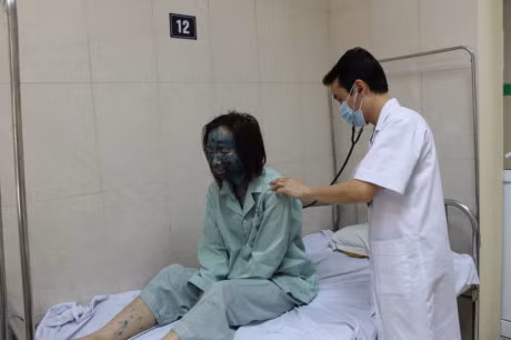 Benh thuy dau bung phat, benh nhan un un nhap vien - Anh 1