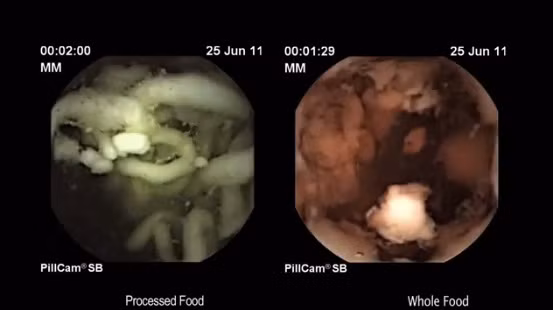 Bằng 1 camera siêu nhỏ hình con nhộng, các chuyên gia đã phát hiện ra rằng sợi mỳ không hề được tiêu hoá trong dạ dày sau 2 tiếng