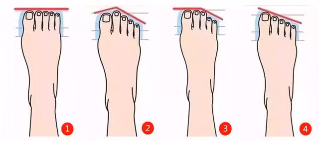 Sở hữu tướng chân này, thuở nhỏ có nghèo hèn, hậu vận sẽ giàu sang - Ảnh 1.