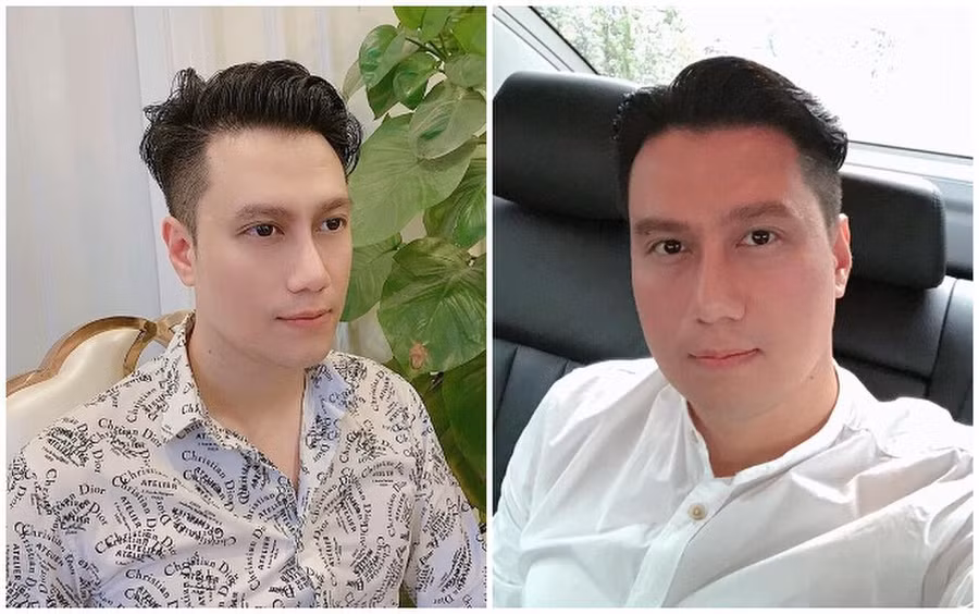 Những sao Việt phẫu thuật thẩm mỹ khiến khán giả xót xa tiếc nuối - Ảnh 1. Những sao Việt phẫu thuật thẩm mỹ khiến khán giả xót xa tiếc nuối - Ảnh 1.