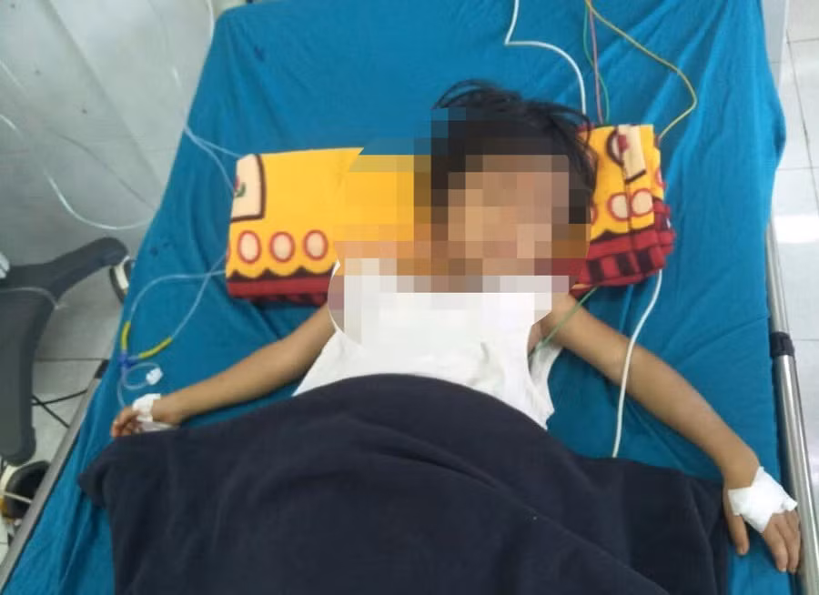 Một trẻ đang được cấp cứu tại bệnh viện sau khi ăn thịt cóc.