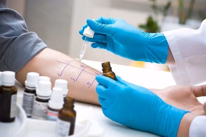 Có thể điều trị viêm mũi dị ứng mạn tính bằng liệu pháp miễn dịch