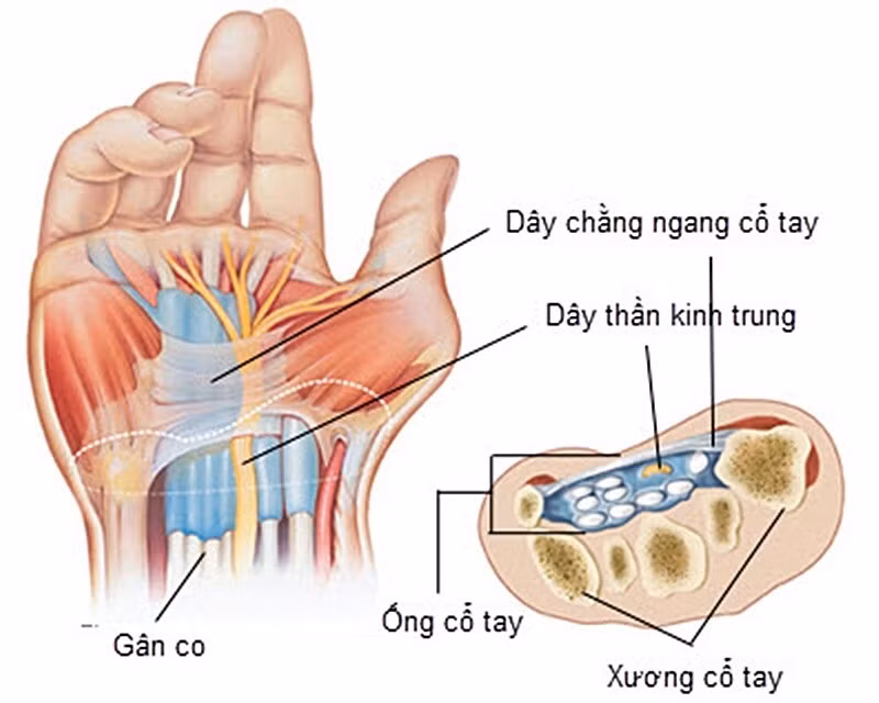 Cổ tay là cấu trúc phức tạp, rất dễ bị tổn thương
