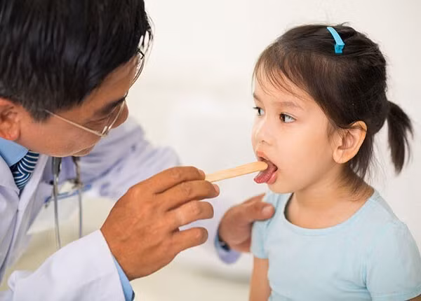 Viêm thanh quản cấp gây khò khè ở trẻ