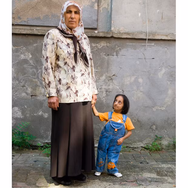 Hatice Kocaman, 21, is the smallest woman in the world. She is just 28 inches tall and weighs only 15lbs, about the same as an eight-month-old baby. She lives with her parents in Kadirli, Osmaniye, Turkey. The country is also home to the world’s tallest man