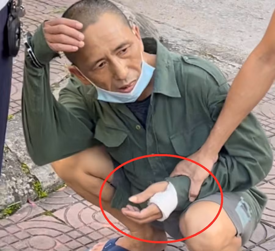 Vũ Anh Dũng có hành vi giấu ma túy bên trong cánh tay bị bó bột để bán cho các con nghiện.