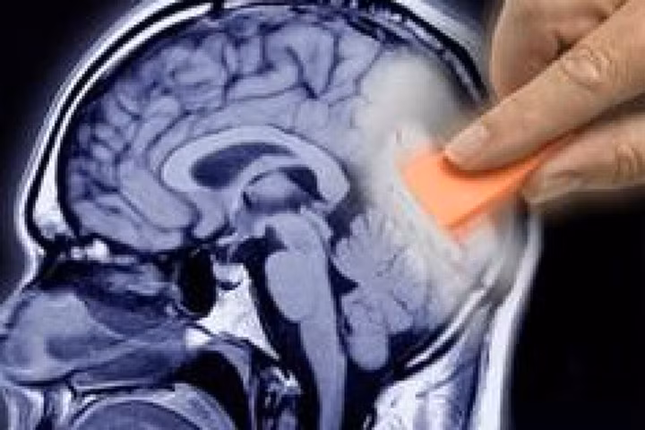 Sử dụng nam châm để tìm lại trí nhớ bị lãng quên