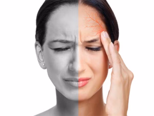 Đau đầu do viêm xoang dễ nhầm lẫn với đau nửa đầu