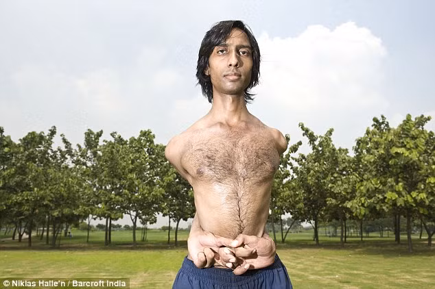 ’Rubber Man’ Vijay Sharma demonstrates his flexibility by winding his arms around his back and wrapping then around his waist in Delhi Read more: http://www.dailymail.co.uk/news/worldnews/article-1254391/The-real-life-flexible-friend-Indias-Rubber-Man-makes-Guinness-Book-World-Records.html#ixzz0jYB3vEVV