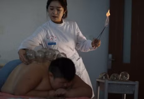 Dung lua dot mo bung, phuong phap giam can cho nhieu tre em beo phi tai Trung Quoc - Anh 3