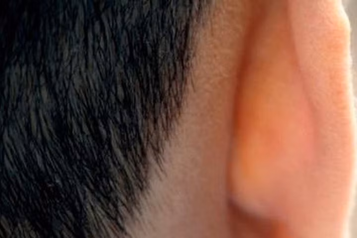 5 vị trí không ngờ có thể bị ung thư da