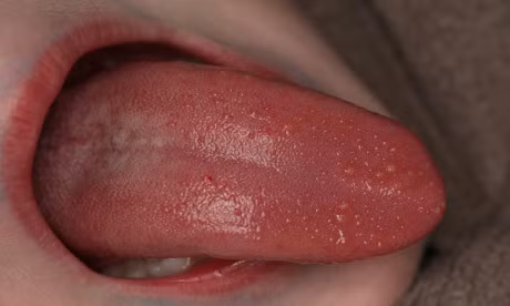 Nam mieng o tre nguy hiem nhu the nao? - Anh 1