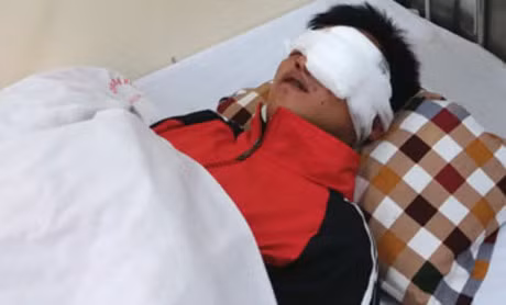 Cut tay, mu mat do dot phao - Anh 2