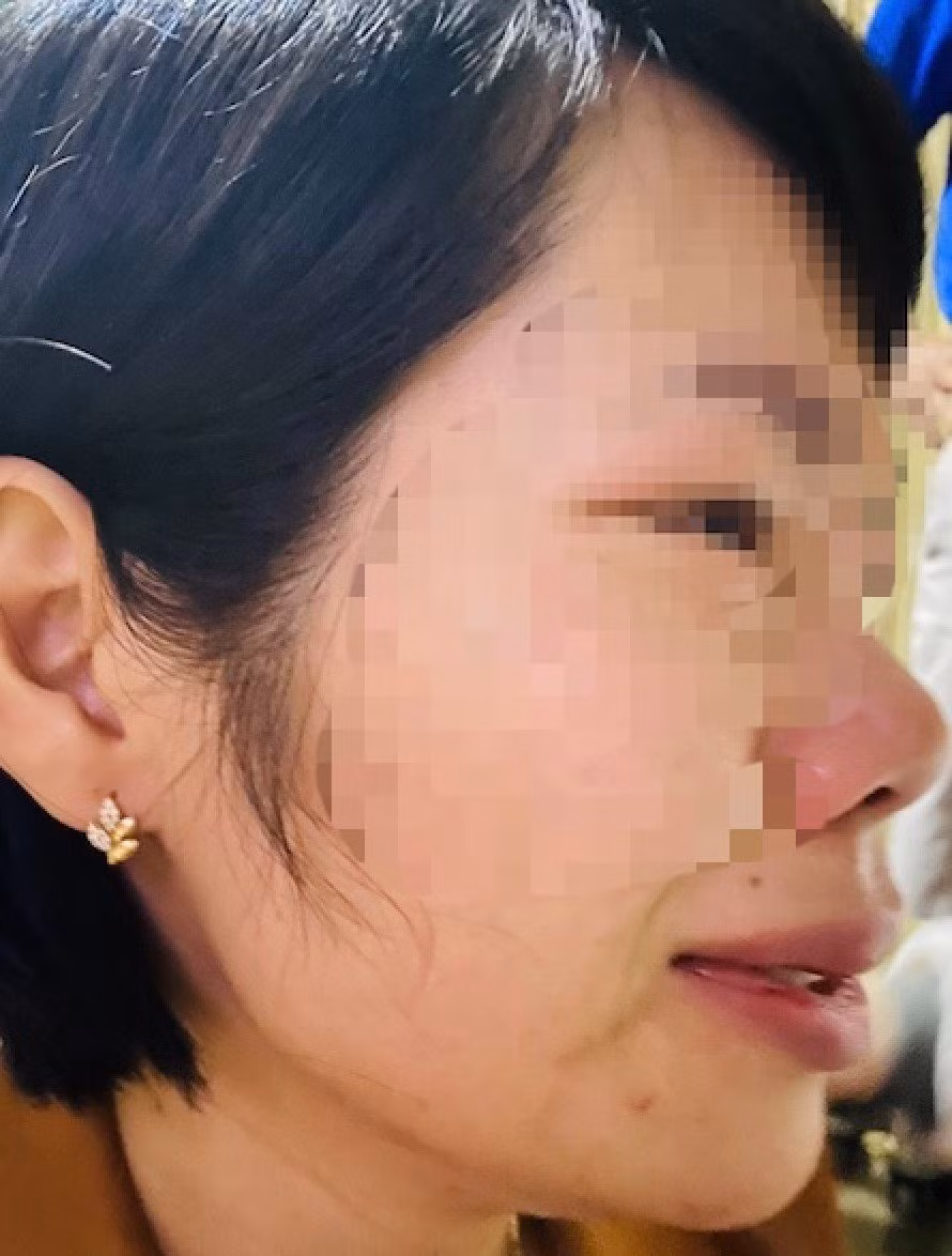Cô Quy bị phụ huynh xông đến nhà hành hung. (Ảnh: CTV)