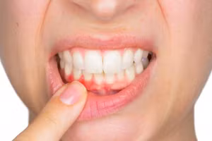 Biết những tác hại kinh hoàng này, liệu bạn còn lười đánh răng buổi sáng?