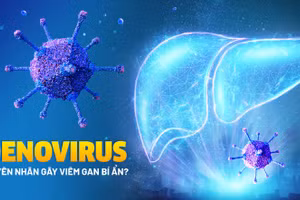 Nguồn: BV.