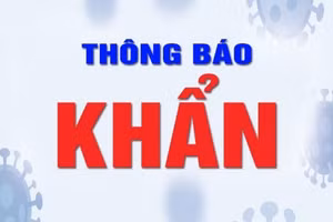 Ảnh minh họa.