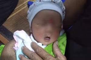 Thái Bình: Bé trai còn nguyên dây rốn bị bỏ trong ba lô bên đường 