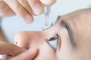 Lạm dụng thuốc nhỏ mắt chứa corticoid gây ra bệnh glaucoma.
