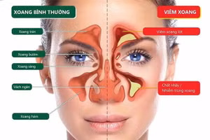 Minh họa/INT