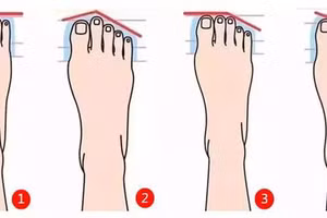 Sở hữu tướng bàn chân này, hậu vận sẽ giàu sang