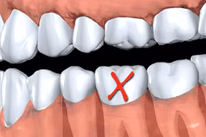 Đi khám răng, người đàn ông bị chỉ định nhổ cả hàm vì sai lầm 2 năm trước 
