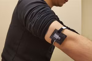 Nhiệt độ và độ pH thường ảnh hưởng đến các số đọc điện hóa của lactate.