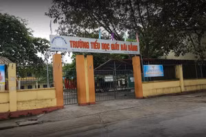 Ảnh minh họa